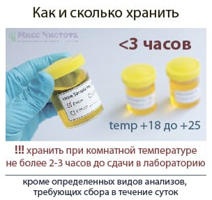 Câtă urină de păstrat pentru analize fiabile