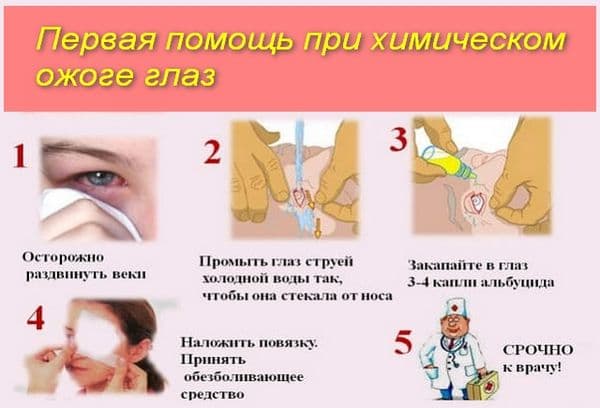 Ajutor cu o arsură chimică