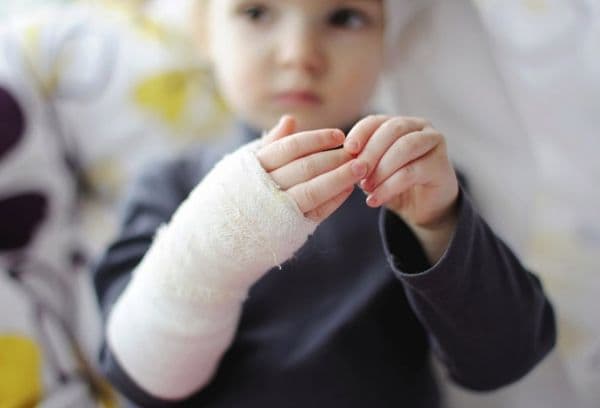 Un copil cu o arsură a mâinilor